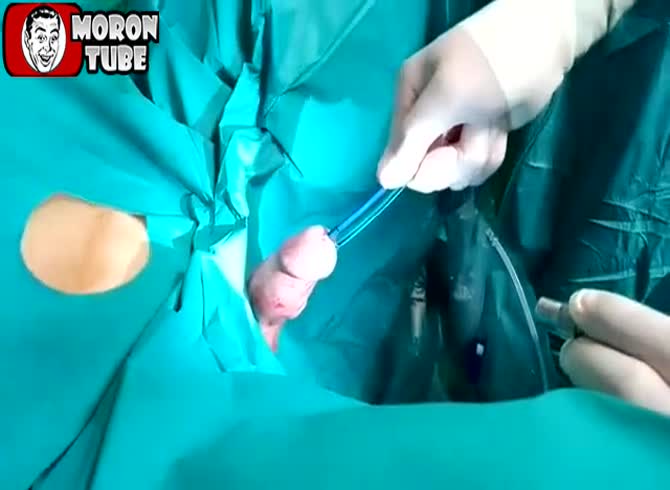 Video :Don't fill your penis with anything! (Informed by the public)